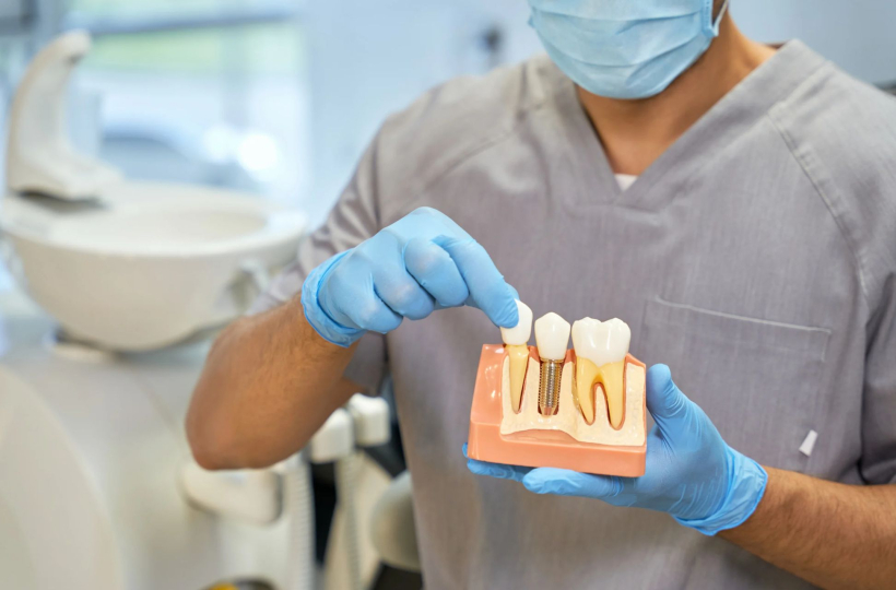 What Insurance Does Dental Works Accept update 2023